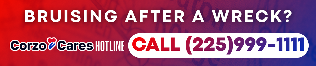 Wide promotional banner with bold text that reads “Bruising After a Wreck?” followed by “Call 225-999-1111.” Smaller text says “Talk to Chris 24/7.” The graphic uses red, purple, and blue tones and promotes immediate legal help after a car accident.